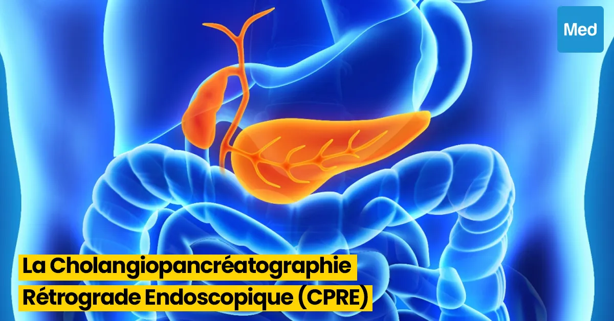 Tout ce que vous devez savoir sur la Cholangiopancréatographie Rétrograde Endoscopique (CPRE)